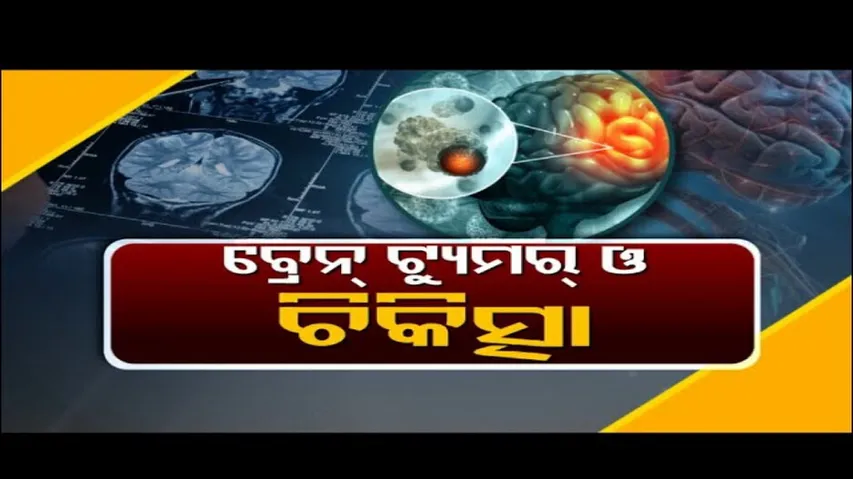 Doctor Doctor | ବ୍ରେନ୍ ଟ୍ୟୁମର୍ ଓ ଚିକିତ୍ସା | Brain tumor - Diagnosis and treatment