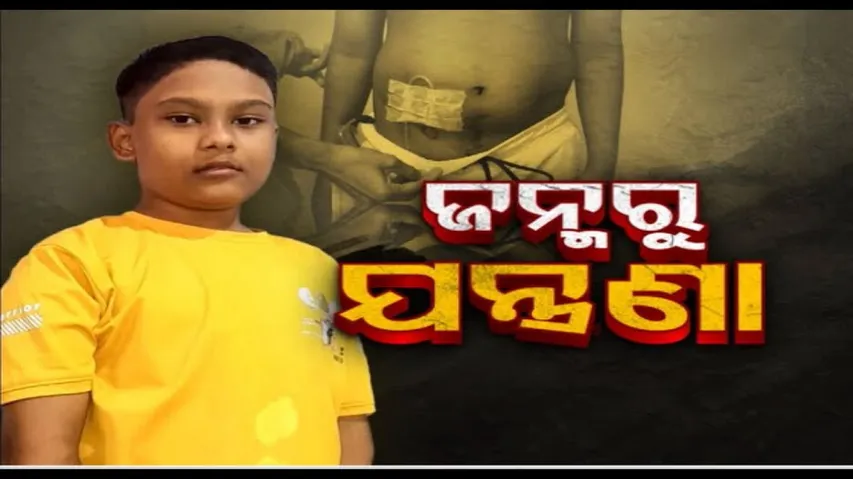 Apana eka nuhanti Ep 702 | 1st nov 2024 | ବୟସ ୧୦ ବର୍ଷ କିନ୍ତୁ ଅପରେସନ ସଂଖ୍ୟା ୧୫|