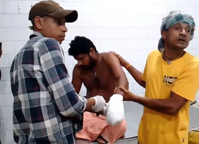 Youth Damages his hand while bursting crackers