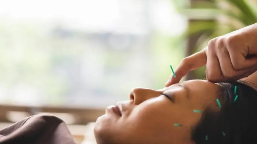 Acupuncture can be safe option to treat migraines
