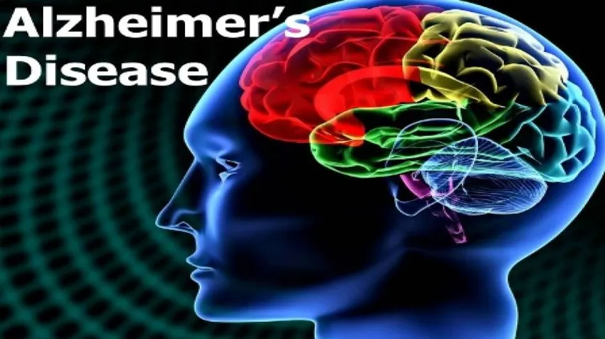 Brain cholesterol may increase Alzheimer's disease risk