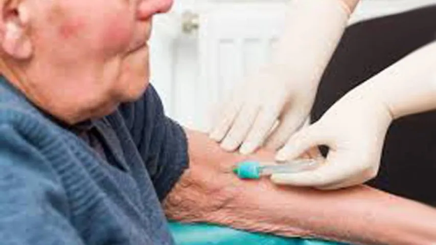 Blood test to spot Alzheimer's before symptoms occur