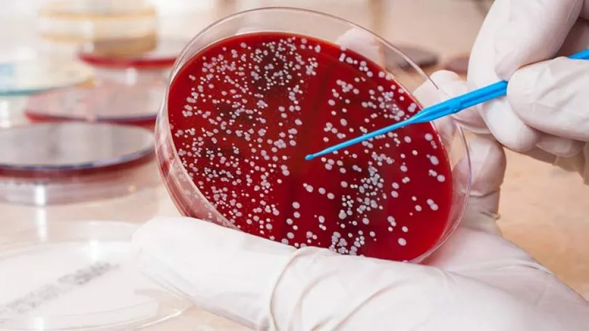 Clinical Trial Shows Promise In Treatment Of Rare Blood Cancer