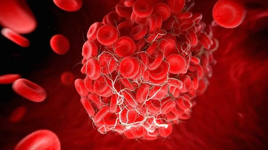 Scientists Discover COVID's Link To Life Threatening Blood Clots