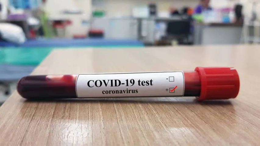 India Reports Over 1K Covid19 Deaths In A Day, Positive Tally Mounts To 27.6 Lakh