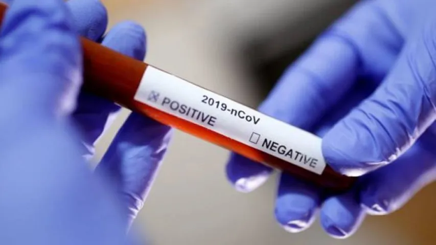 Techie Tests Positive For COVID19 In Bhubaneswar ESI Hospital Colony
