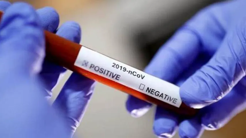 Doctor Accuses Wuhan Officials Of Covering-Up COVID-19 Outbreak