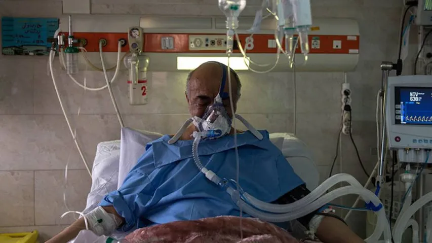 COVID-19 ICU Patients At Risk Of Acute Brain Dysfunction: Study