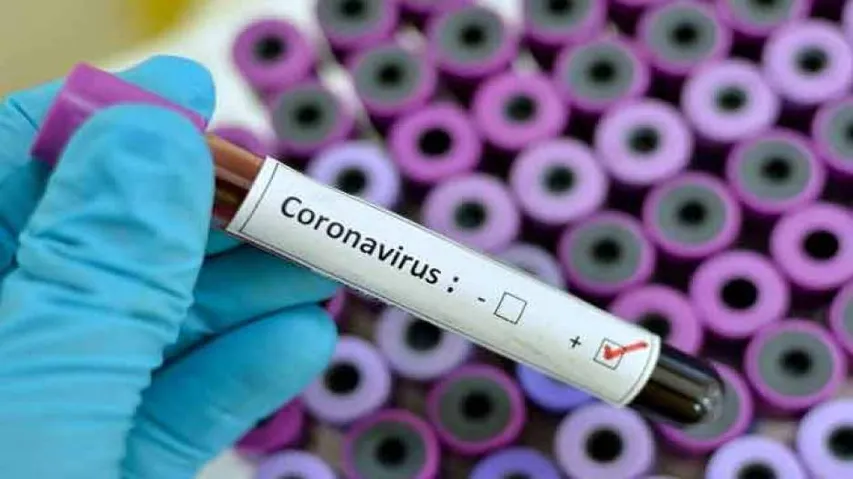 China Announces Reward For Undergoing Coronavirus Test