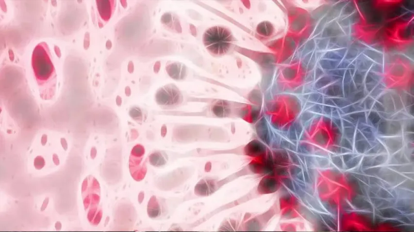 COVID-19 Cases Worldwide Surpass 31.2 Million, Toll Over 963000