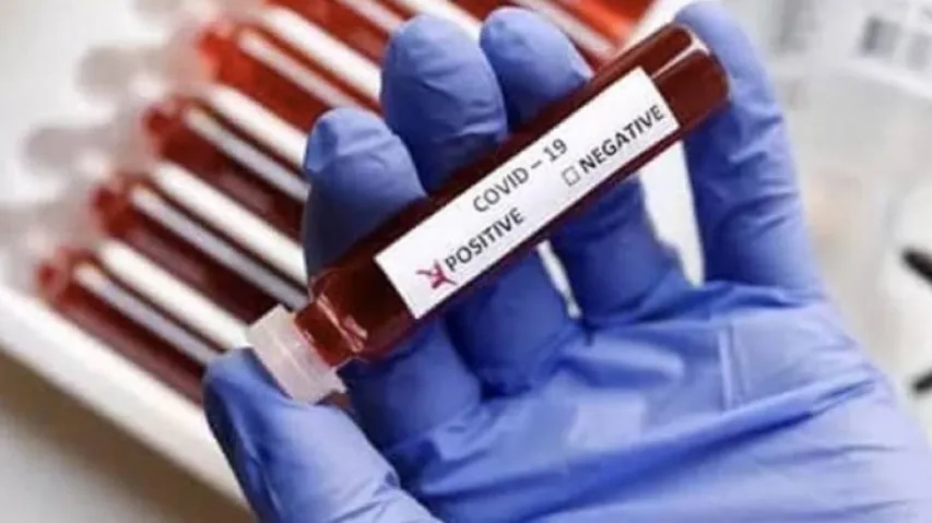 Coronavirus Updates From Around The World Today