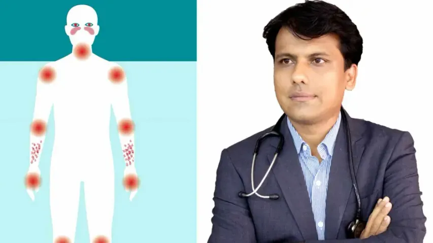 World Lupus Day 2022