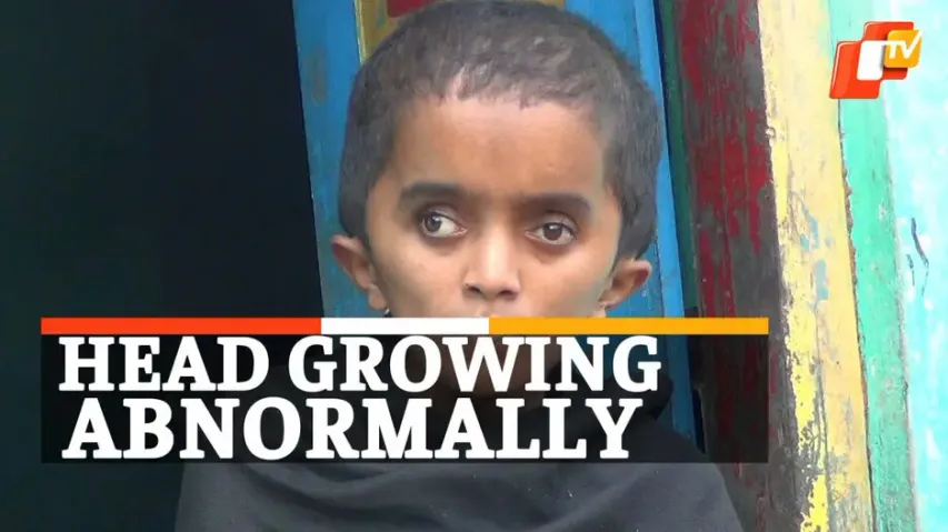 Rare Disease, Girl Seeks Government Help, Kandhamal