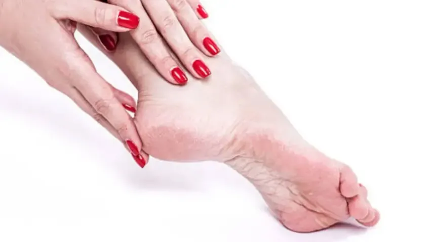 Get rid of cracked skin on heels overnight, follow this simple home pedicure