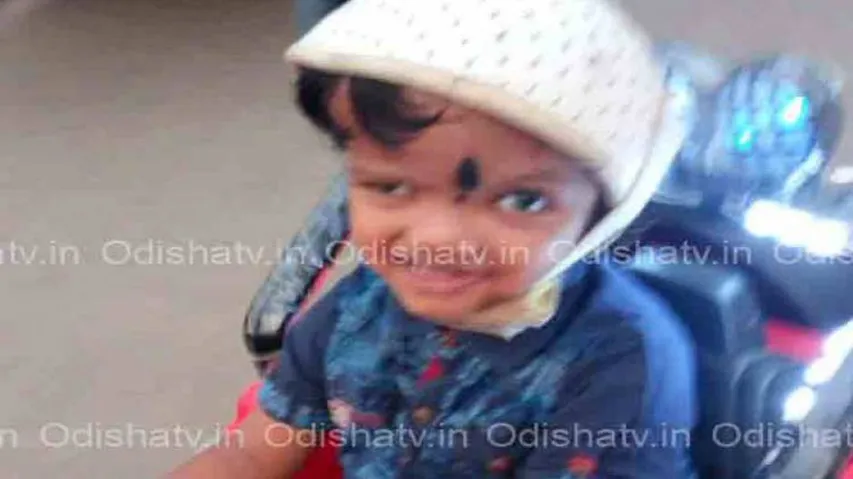 Separation of Conjoined Twins: One year on, Jaga’s improvement beyond expectation