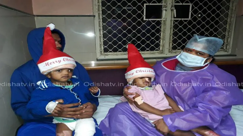 Separation of conjoined twins: Skin grafting carried out on Jaga’s skull