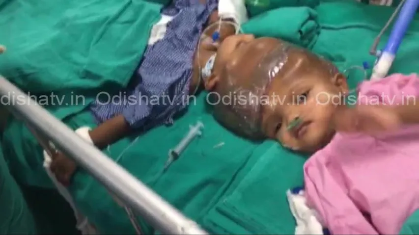 Prayers answered! Jaga-Kalia discharged from OT, under observation