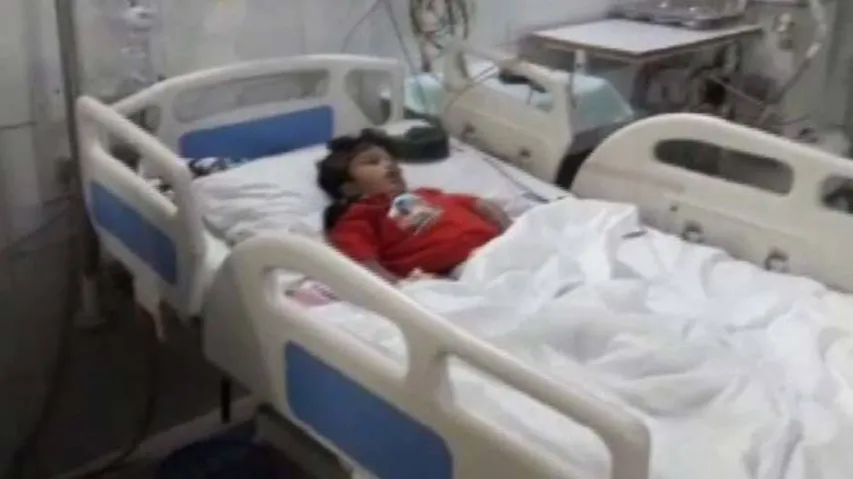 Odisha's Separated Conjoined Twin Kalia Still Critical