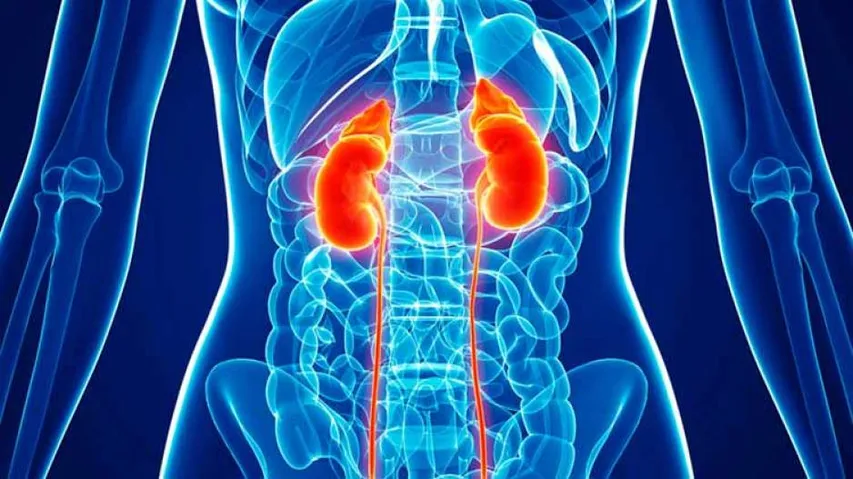 Heavy, tall kids at higher risk of kidney cancer