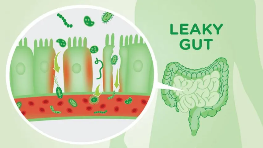 Indian-Origin Scientist Finds Dead Probiotic That Can Fix Leaky Gut
