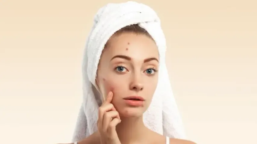 Skincare in winters