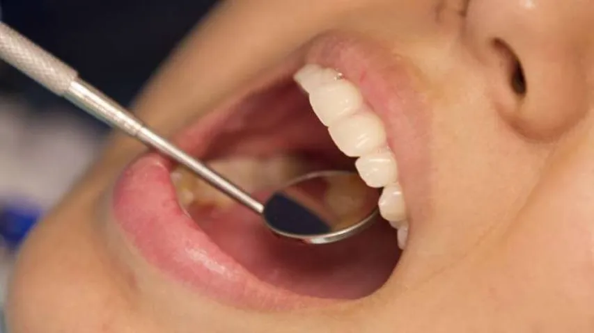 Poor oral health escalates liver cancer risk