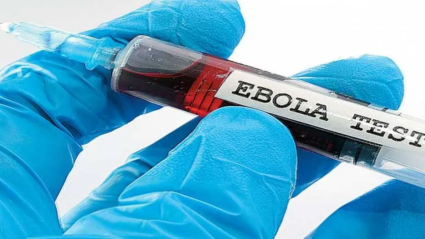 Potent antibodies against 3 Ebola viruses found