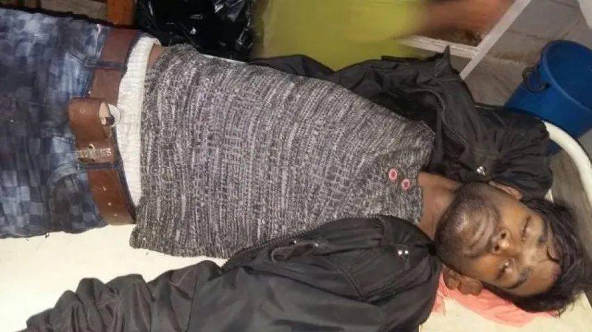 Dreaded criminal injured in police encounter