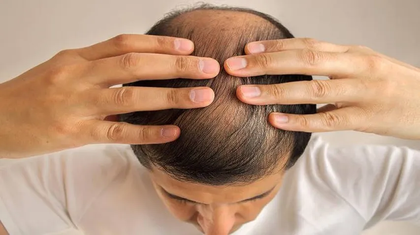 Gene linked to hair loss may improve cancer treatment
