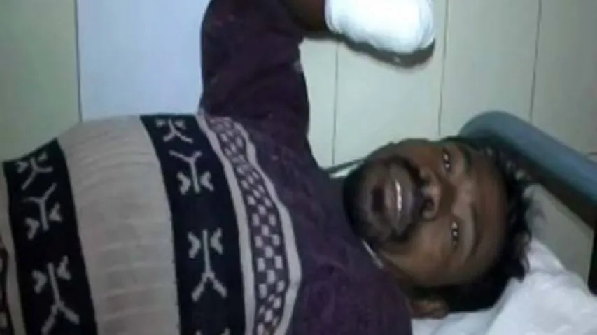 Hand chopping case: SC notice to Odisha, AP 