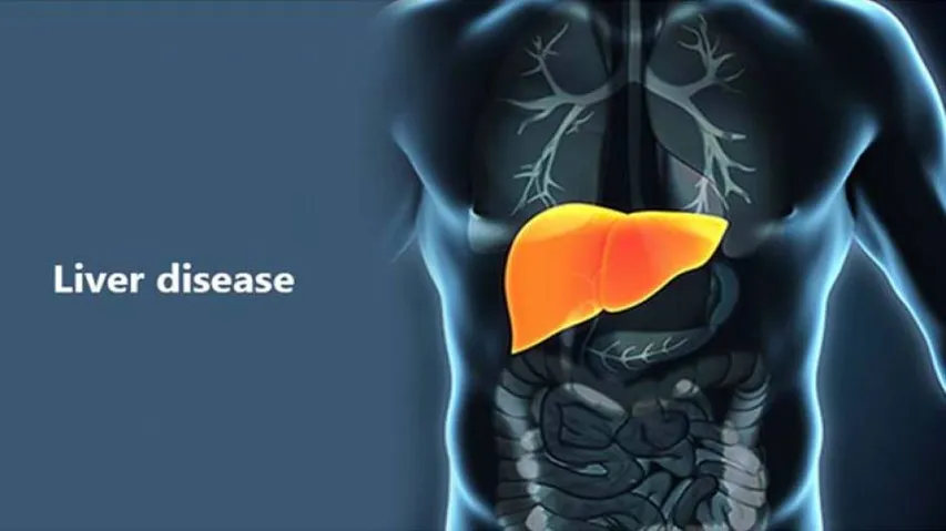 Blood Tests Can Predict Risk Of Severe Liver Disease