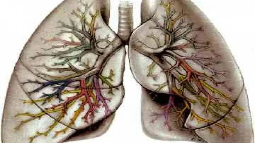 Doctors can now 'see' lung sounds, detect disorders