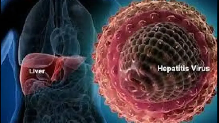 How hepatitis is linked with diabetes, HIV