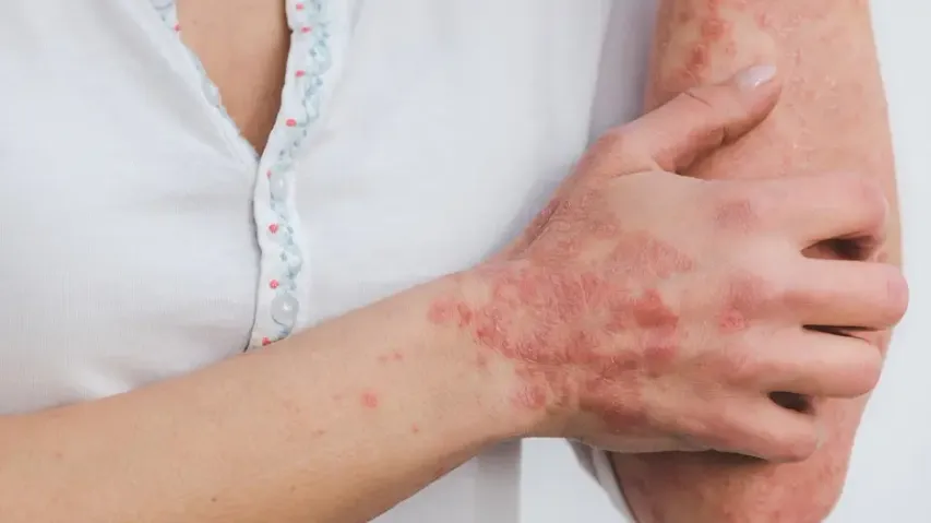 signs of inflammation