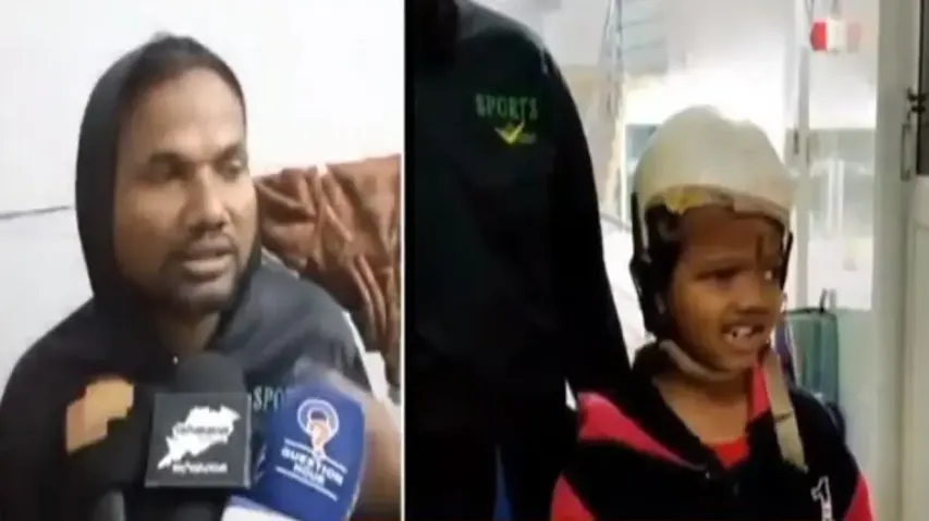 Conjoined twins survivor Jaga, father injured in attack 