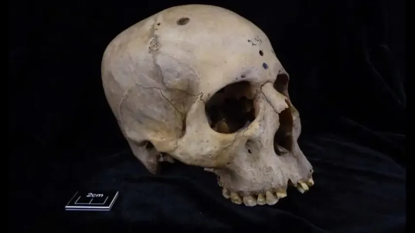 4000 year old skull