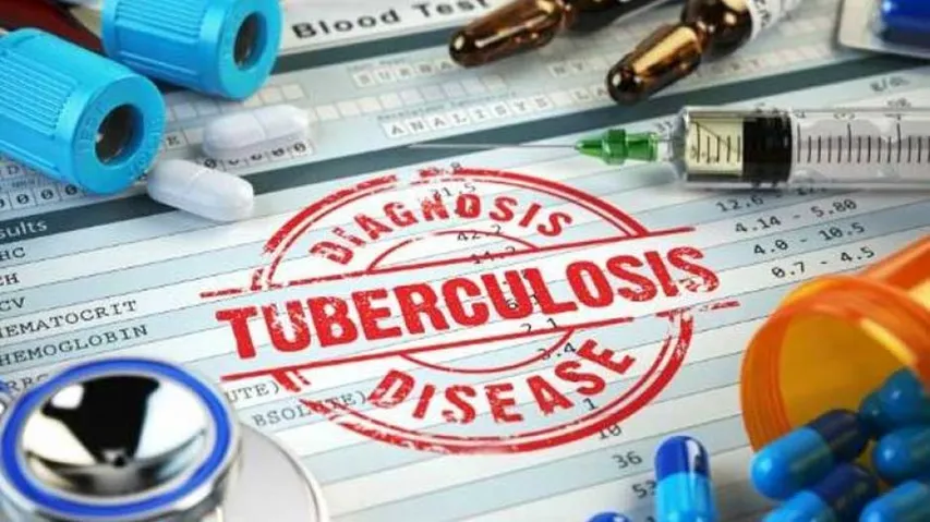 TB Not A Life-Long Infection In Most People: Study