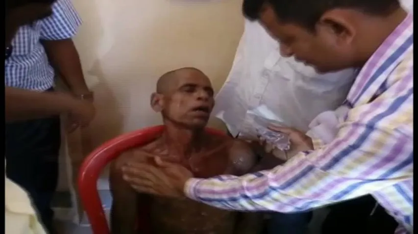 Poor man attempts suicide for failing to get a ration card