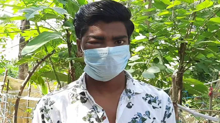 Odisha: Man on the verge of losing vision after hit with a baton by police