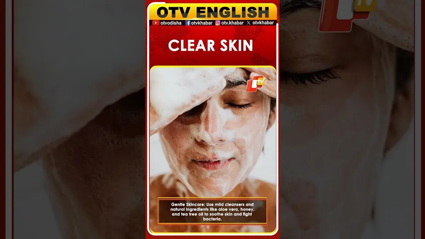 7 Natural Ways to Treat Acne from the Root | OTV