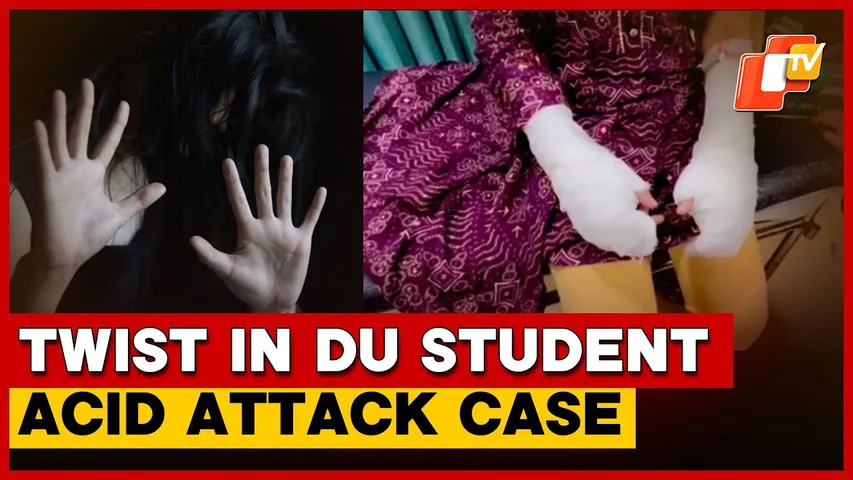 DU Student’s Family Faked Acid Attack To Settle Old Disputes, Probe Reveals