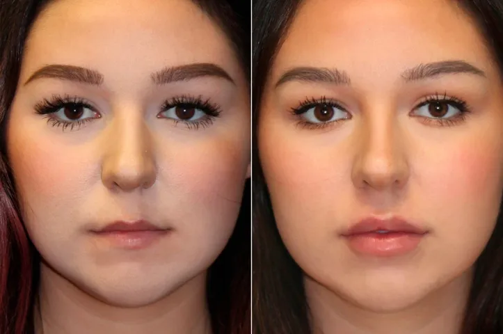 Plastic and Lip Surgery