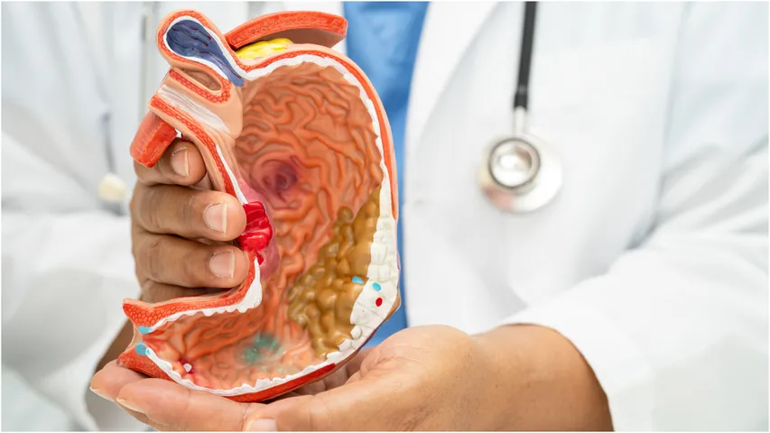 fatty liver