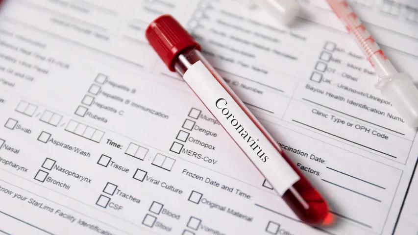 HIV report