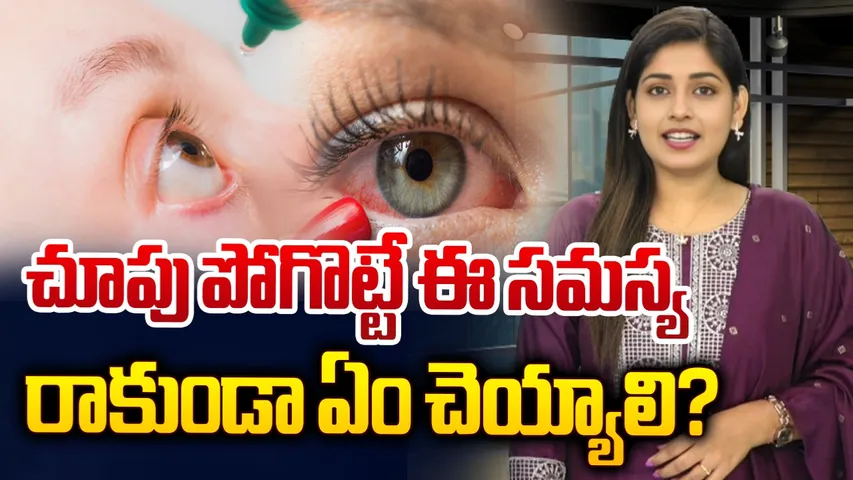 EYE Problems 