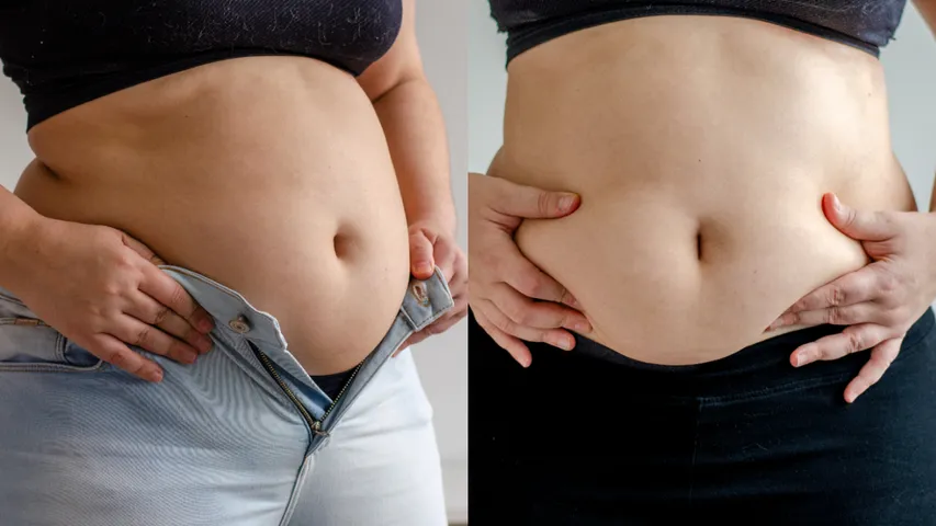 Belly Fat