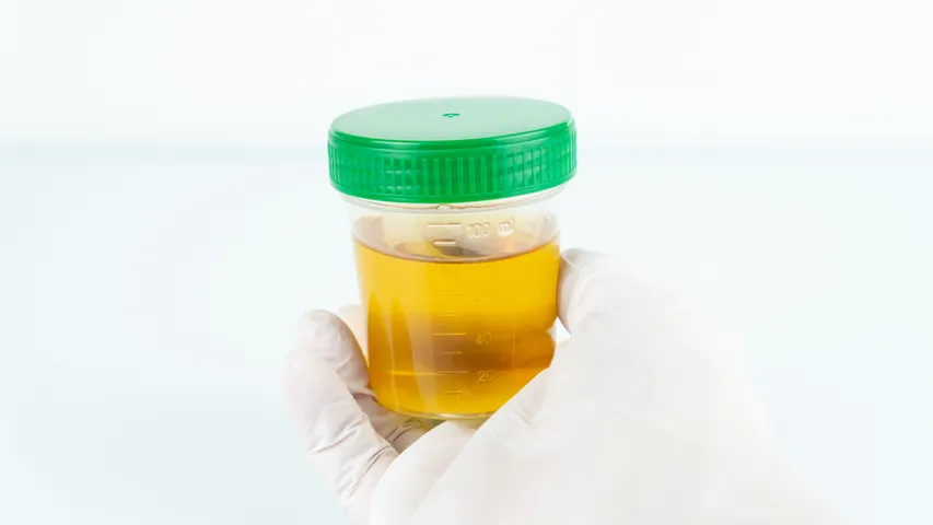 urine