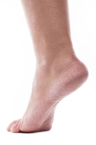 dehydrated-skin-on-the-heels-of-female-feet-2023-11-27-05-00-49-utc (1)