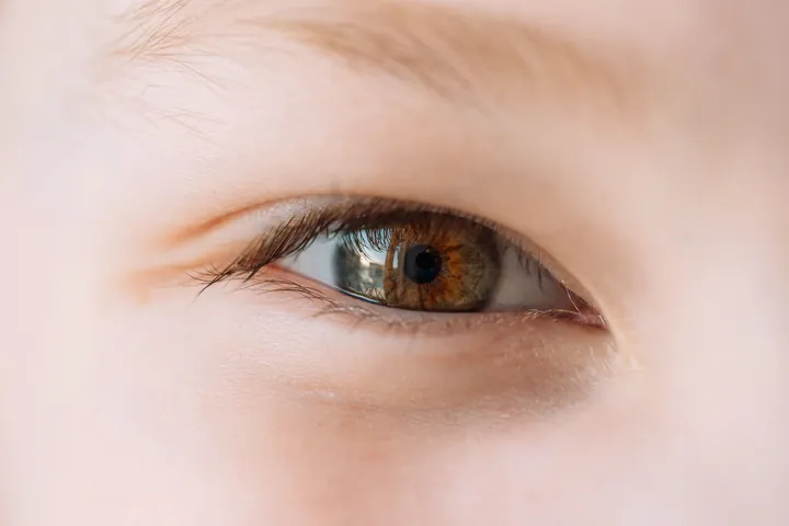 Swellingeyes1