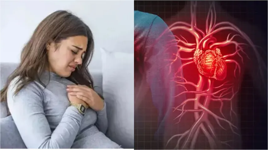 heart attackq